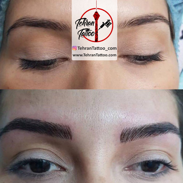 micropigmentation fibrows