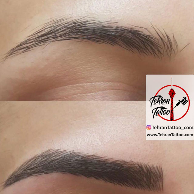 micropigmentation