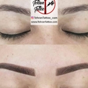 موارد استفاده در میکروپیگمنتیشن کدامند